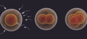 causes de linfertilité