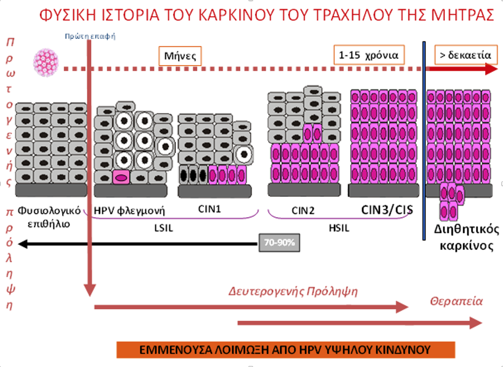 Το ακόλουθο διάγραμμα απεικονίζει τη φυσική ιστορία της επίμονης ογκογόνου λοίμωξης από τον HPV